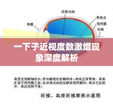 一下子近视度数激增现象深度解析