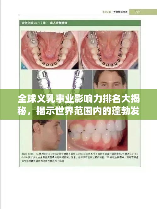 全球义乳事业影响力排名大揭秘，揭示世界范围内的蓬勃发展态势
